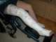 Mein echter Gips